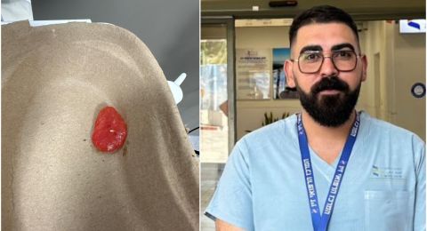 انقاذ حياة شخص اختنق بقطعة بطيخ في حالة نادرة الحدوث